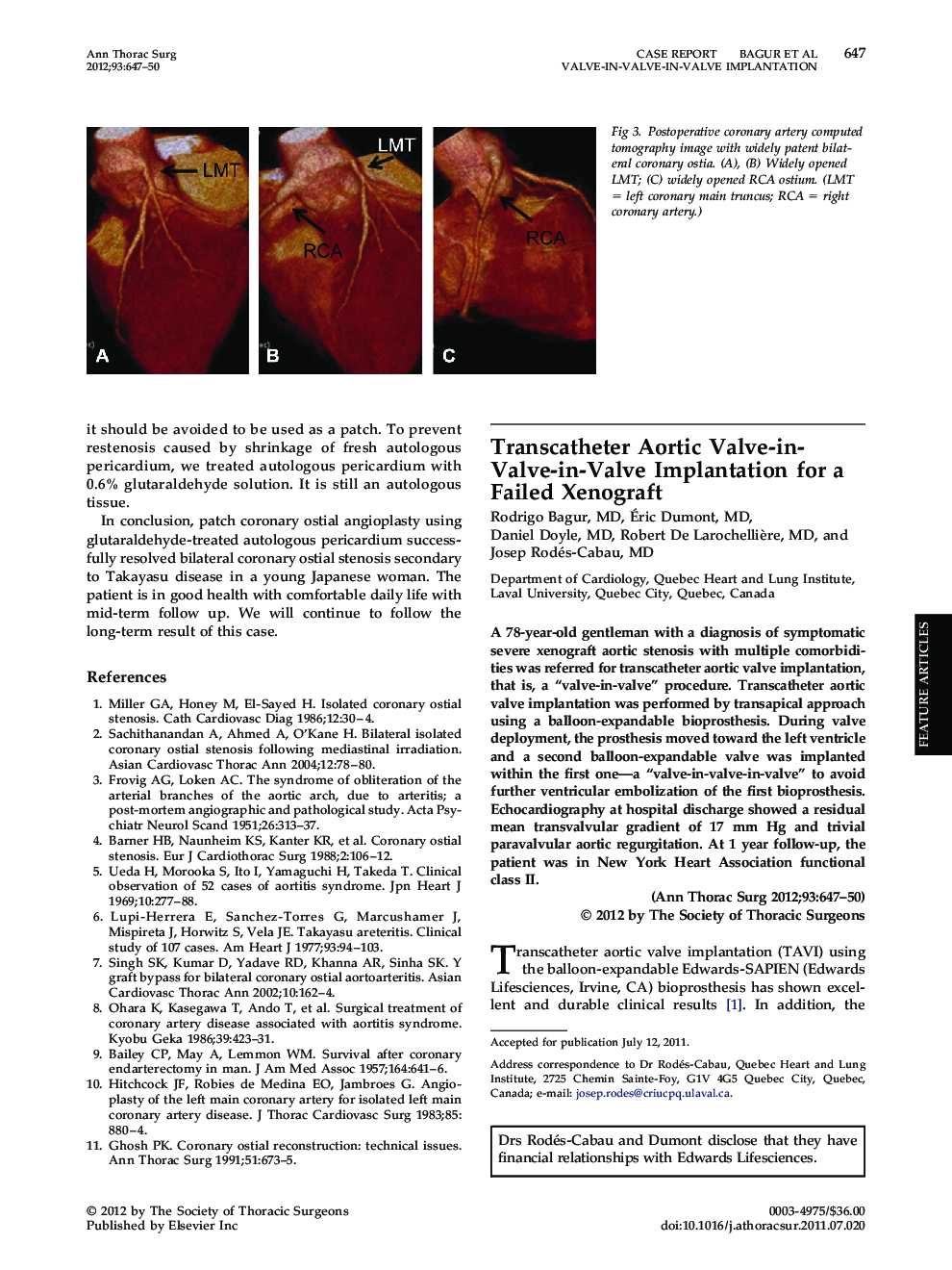 Transcatheter Aortic Valve-in-Valve-in-Valve Implantation for a Failed Xenograft