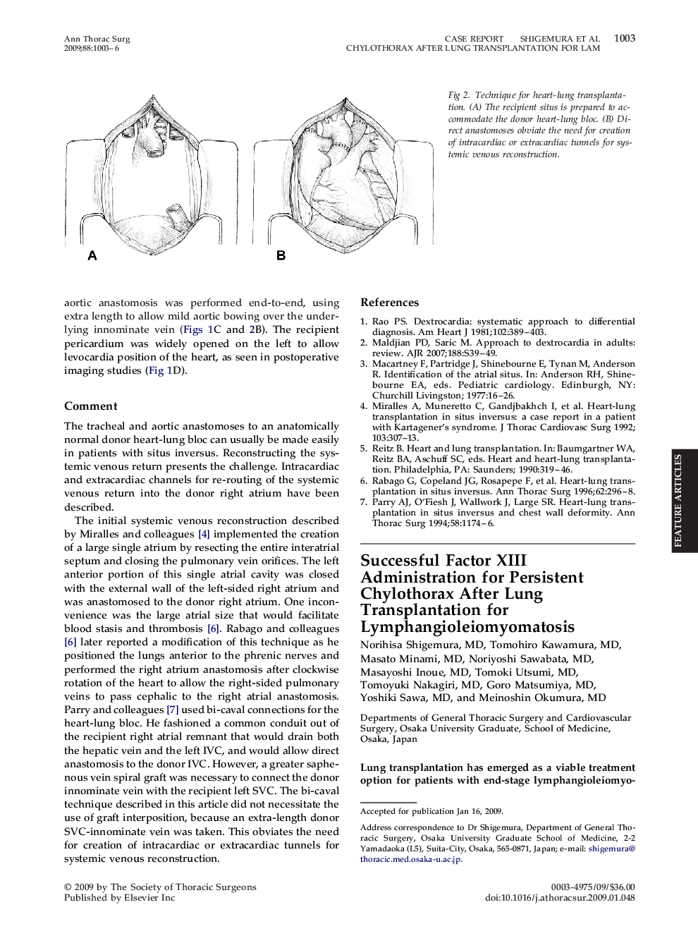 Successful Factor XIII Administration for Persistent Chylothorax After Lung Transplantation for Lymphangioleiomyomatosis