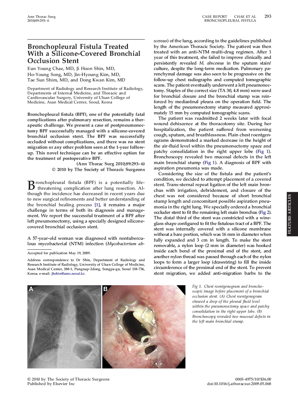 Bronchopleural Fistula Treated With a Silicone-Covered Bronchial Occlusion Stent