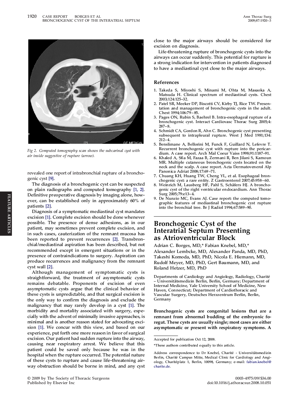 Bronchogenic Cyst of the Interatrial Septum Presenting as Atrioventricular Block