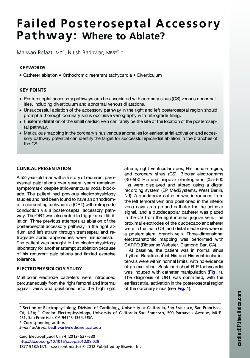 Failed Posteroseptal Accessory Pathway