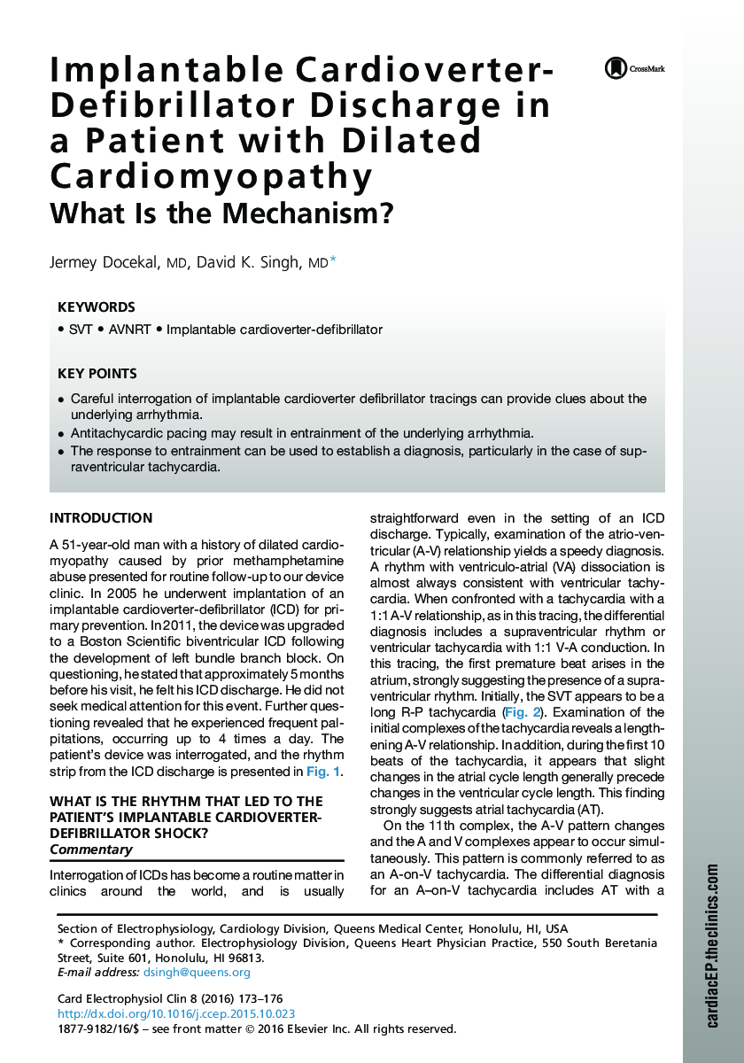 Implantable Cardioverter-Defibrillator Discharge in a Patient with Dilated Cardiomyopathy