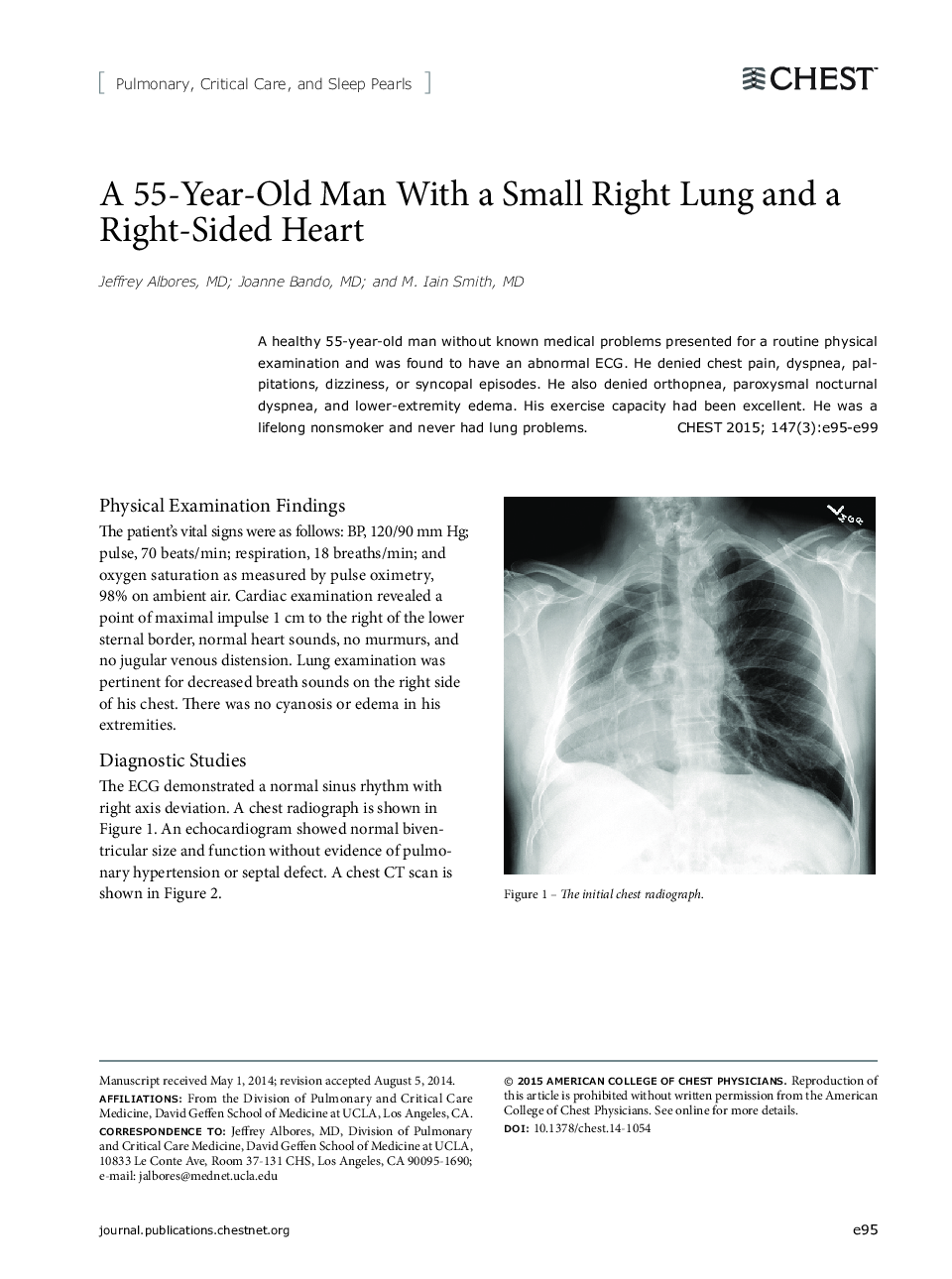 A 55-Year-Old Man With a Small Right Lung and a Right-Sided Heart 