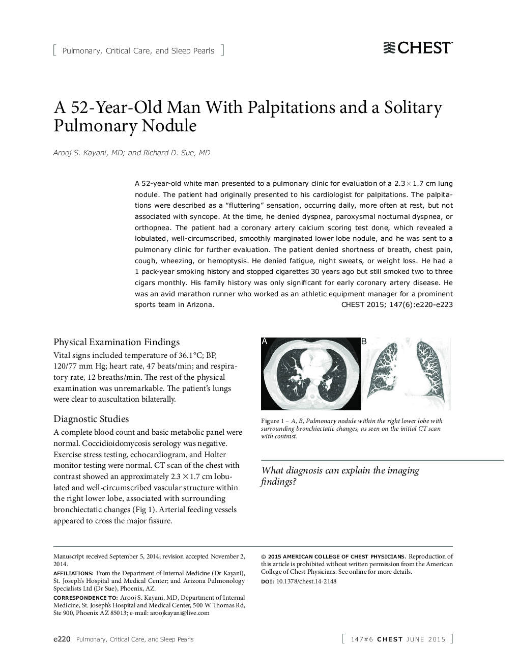 A 52-Year-Old Man With Palpitations and a Solitary Pulmonary Nodule 
