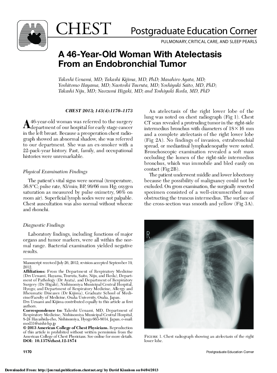A 46-Year-Old Woman With Atelectasis From an Endobronchial Tumor