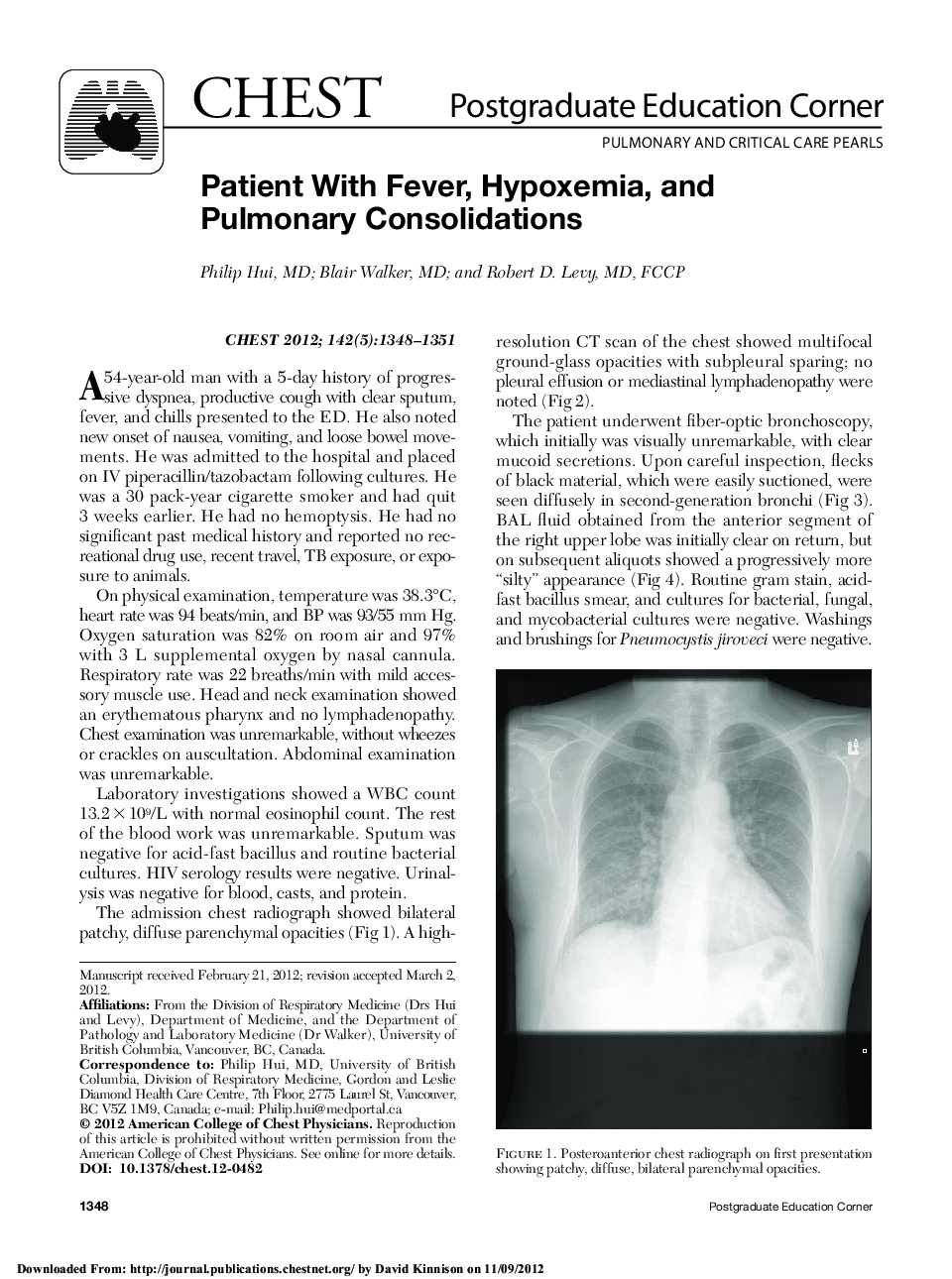 Patient With Fever, Hypoxemia, and Pulmonary Consolidations