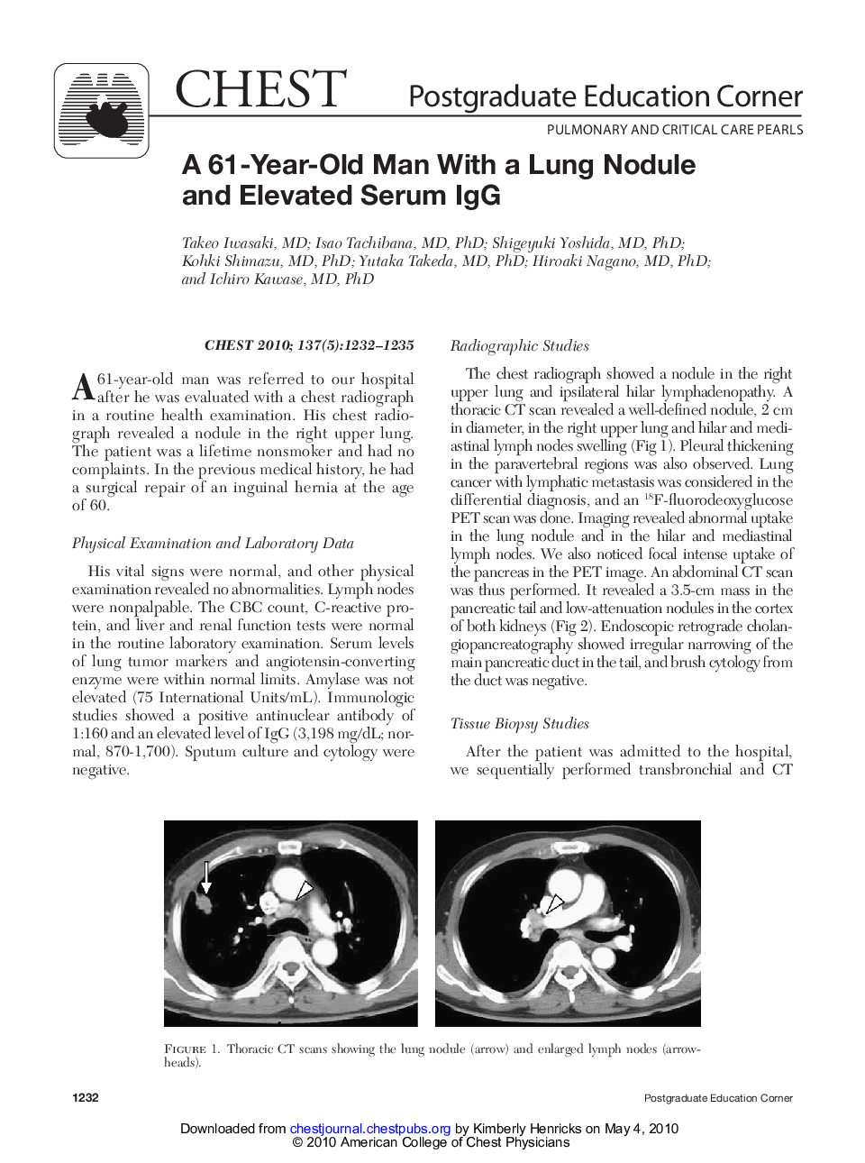 A 61-Year-Old Man With a Lung Nodule and Elevated Serum IgG