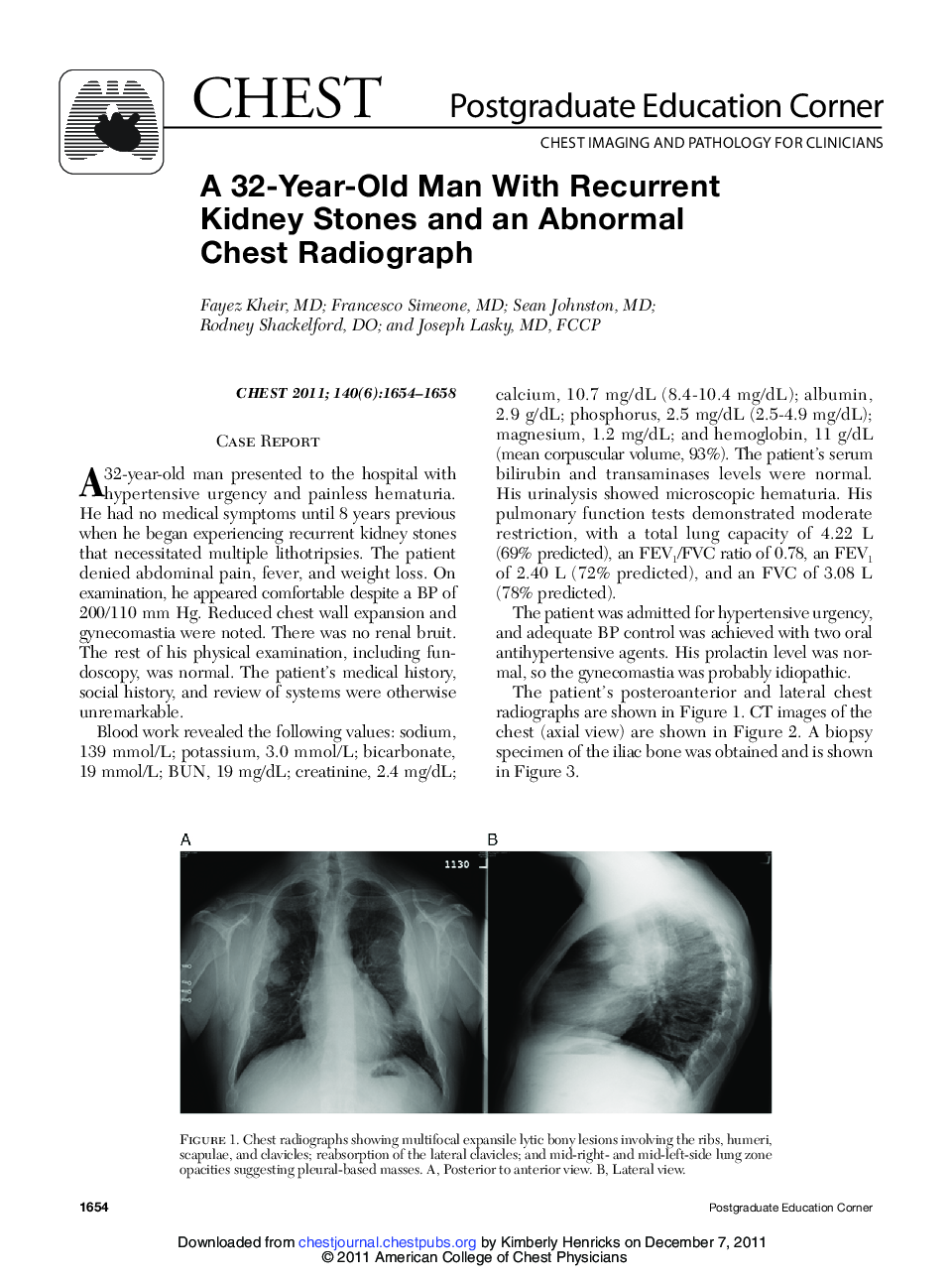 A 32-Year-Old Man With Recurrent Kidney Stones and an Abnormal Chest Radiograph