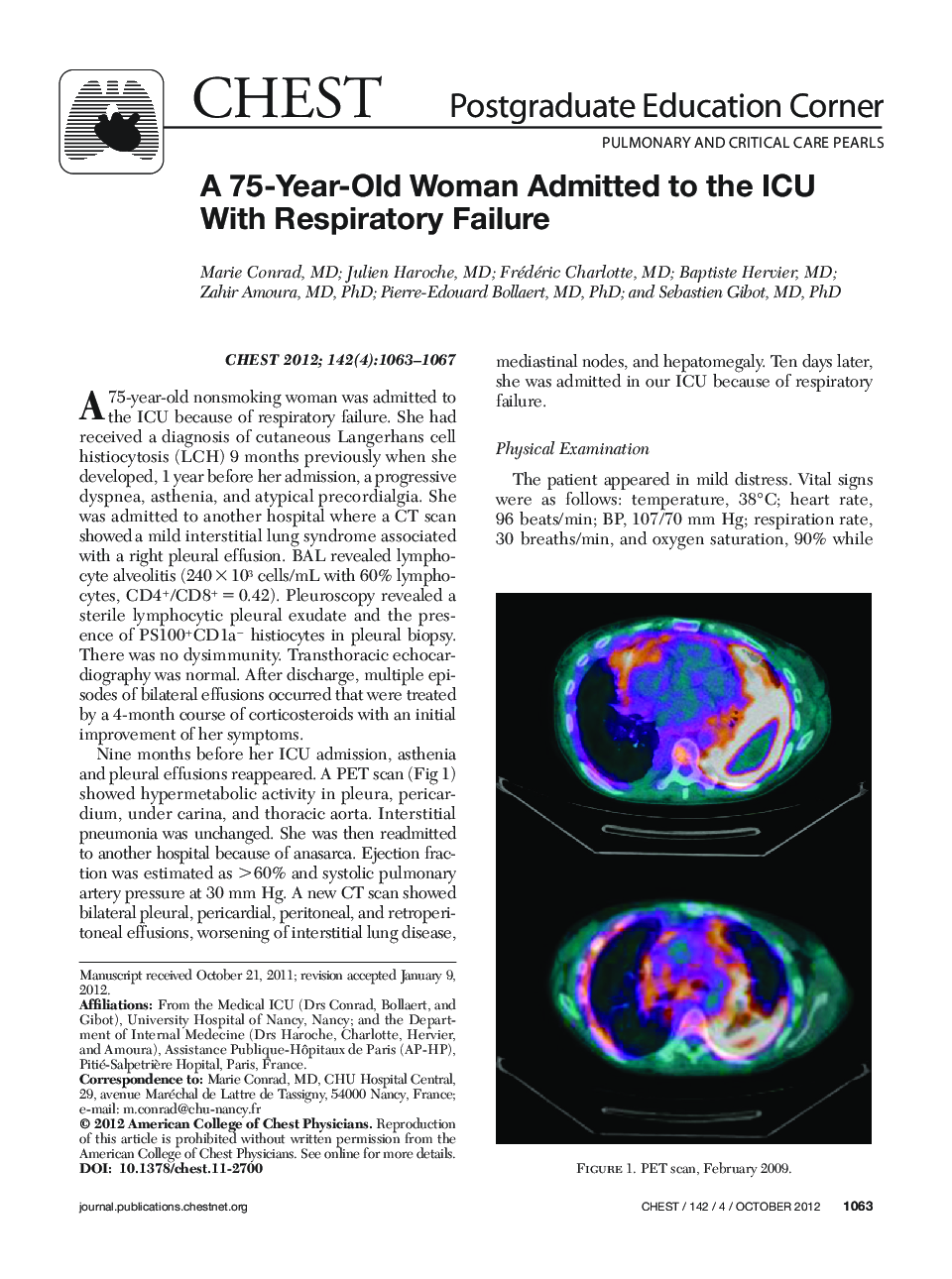 A 75-Year-Old Woman Admitted to the ICU With Respiratory Failure