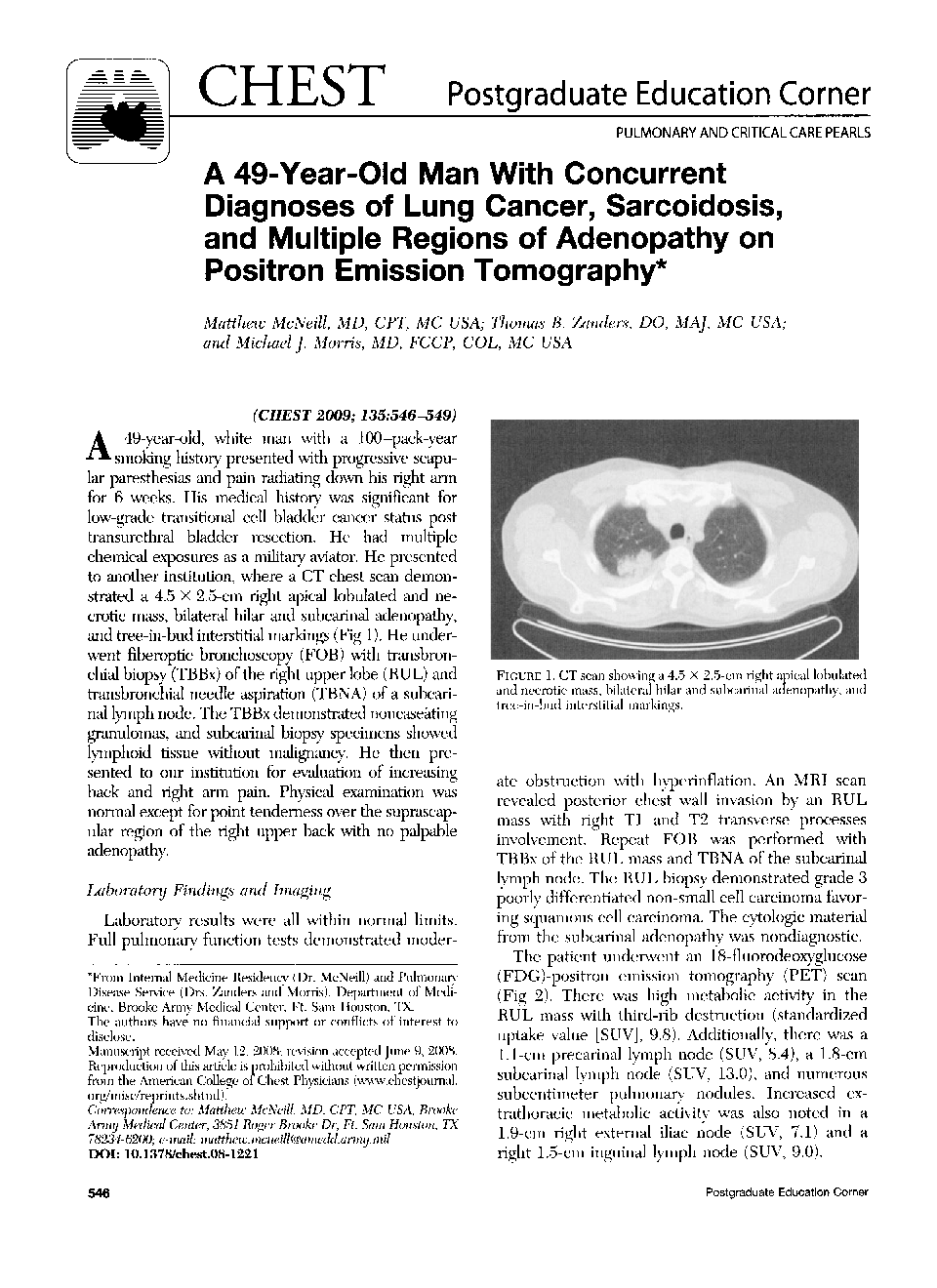 A 49-Year-Old Man With Concurrent Diagnoses of Lung Cancer, Sarcoidosis, and Multiple Regions of Adenopathy on Positron Emission Tomography