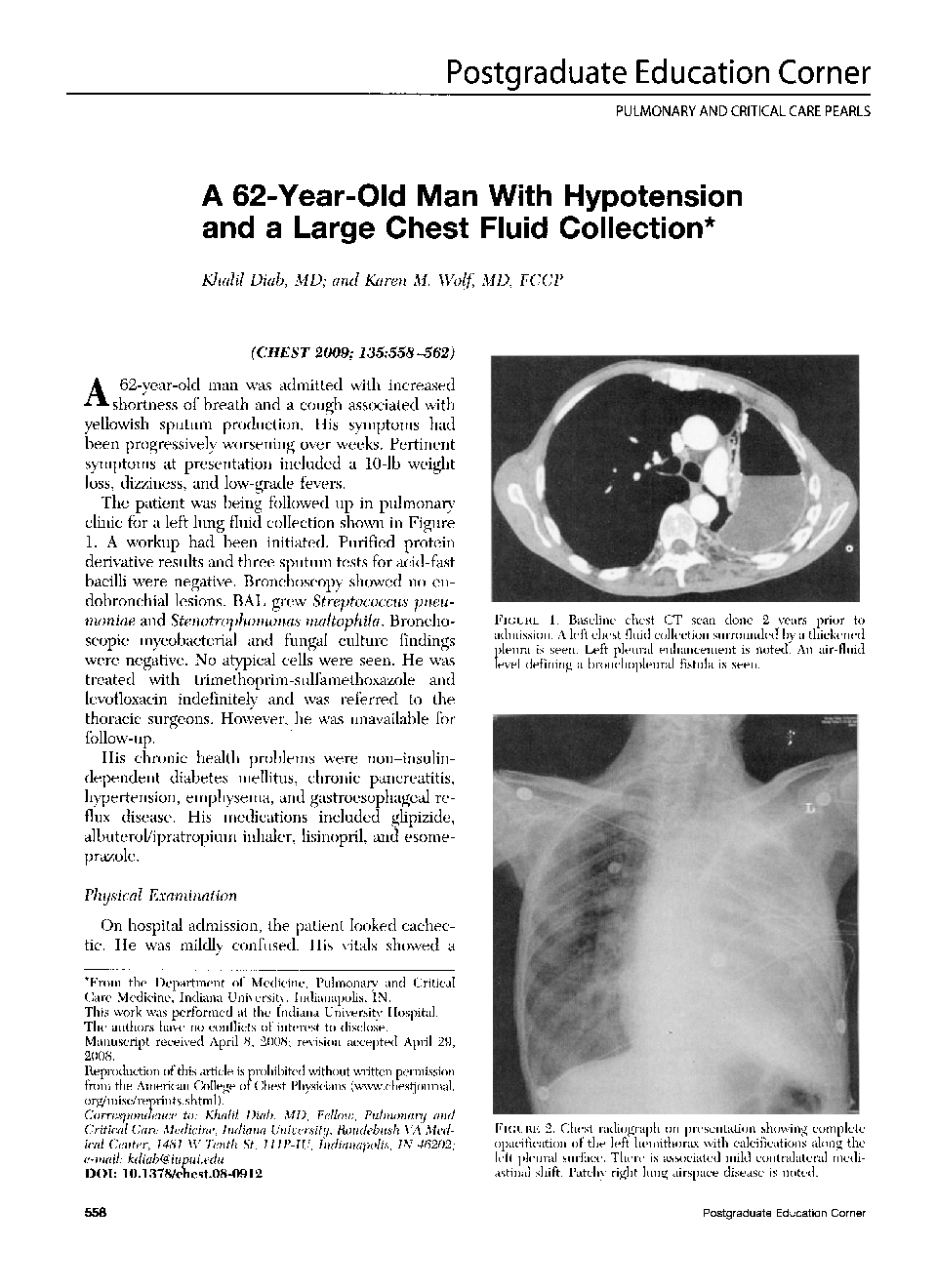 A 62-Year-Old Man With Hypotension and a Large Chest Fluid Collection