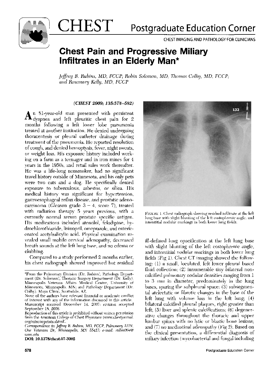 Chest Pain and Progressive Miliary Infiltrates in an Elderly Man