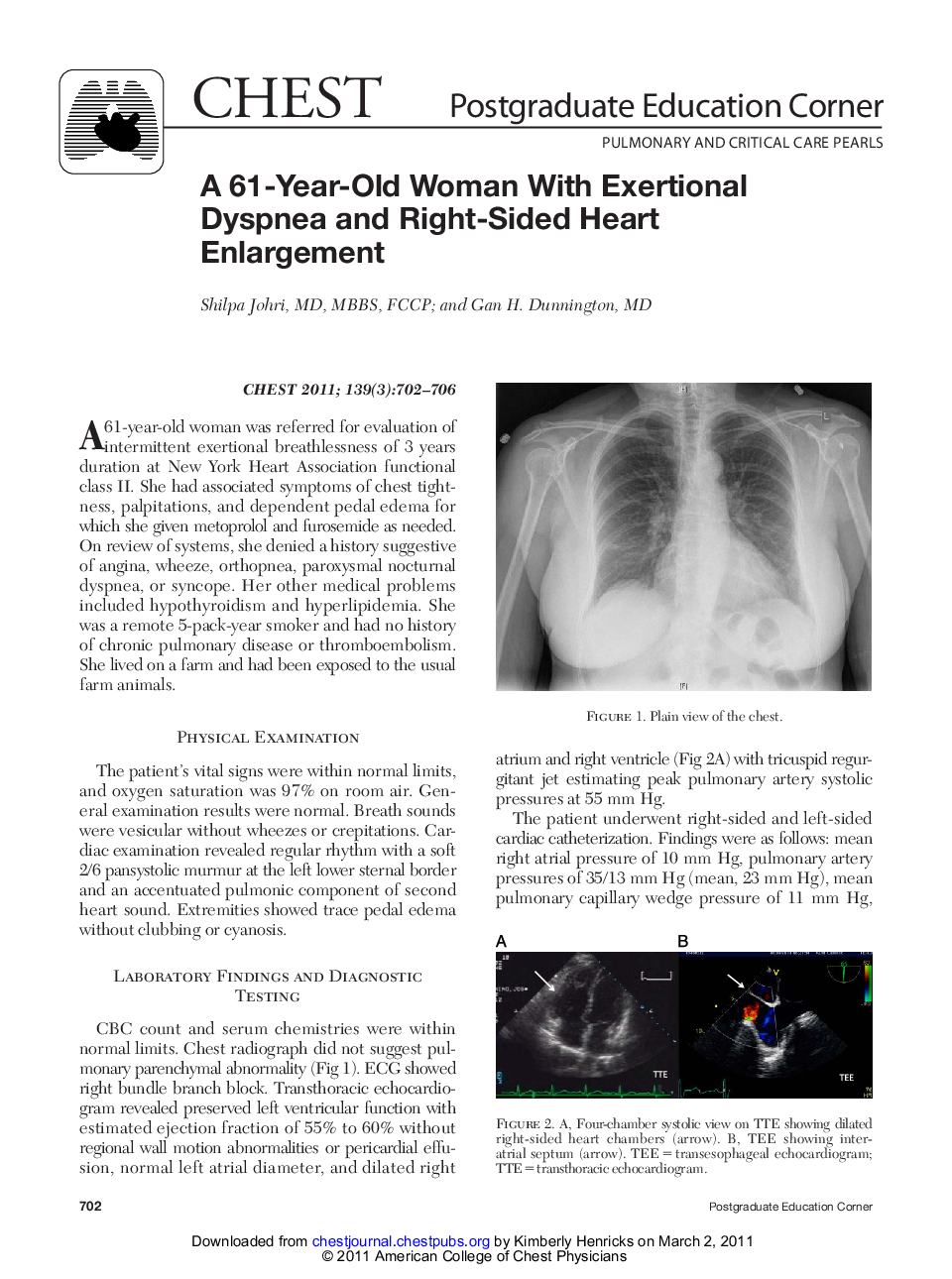 A 61-Year-Old Woman With Exertional Dyspnea and Right-Sided Heart Enlargement
