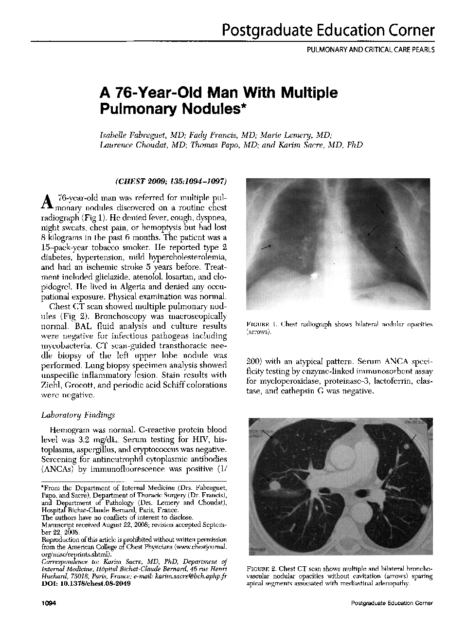 A 76-Year-Old Man With Multiple Pulmonary Nodules