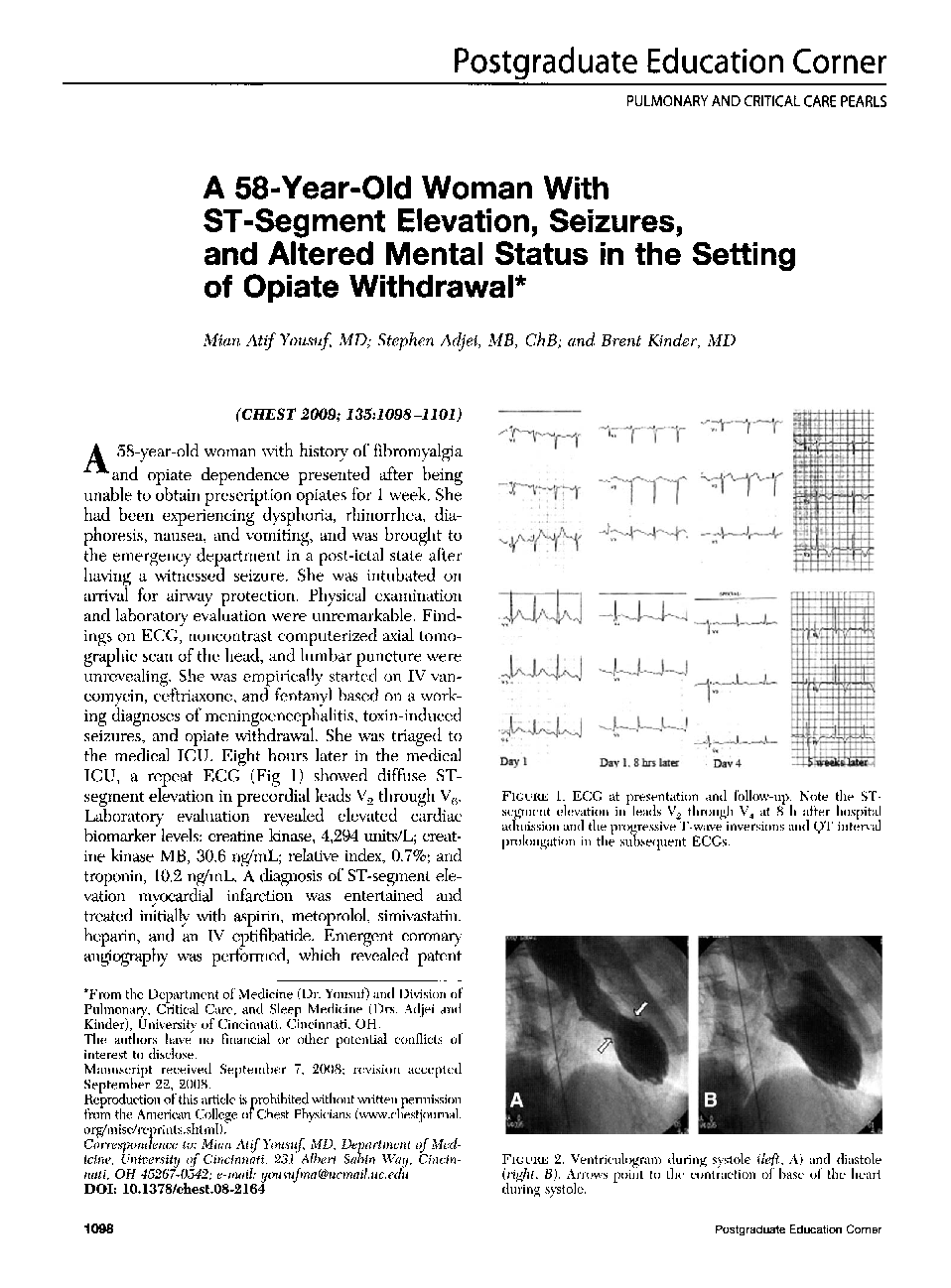A 58-Year-Old Woman With ST-Segment Elevation, Seizures, and Altered Mental Status in the Setting of Opiate Withdrawal