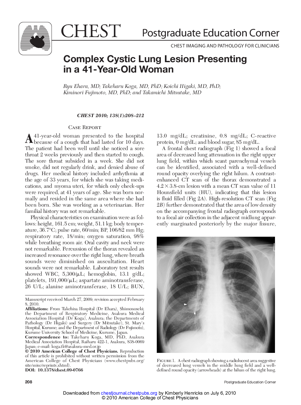 Complex Cystic Lung Lesion Presenting in a 41-Year-Old Woman