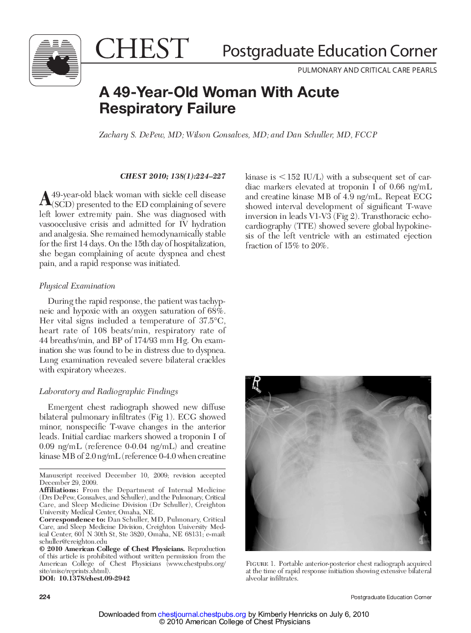 A 49-Year-Old Woman With Acute Respiratory Failure