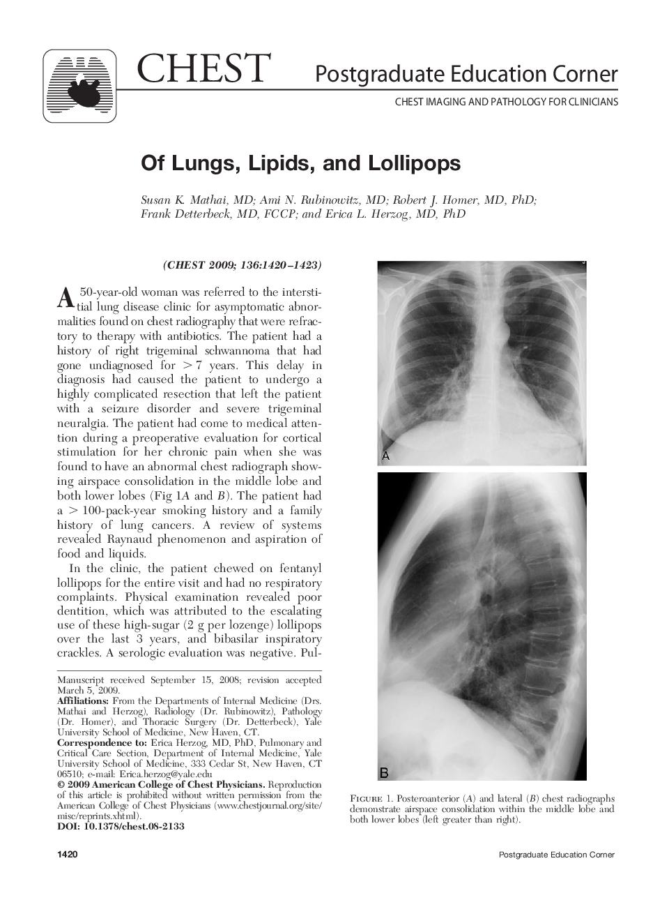 Of Lungs, Lipids, and Lollipops