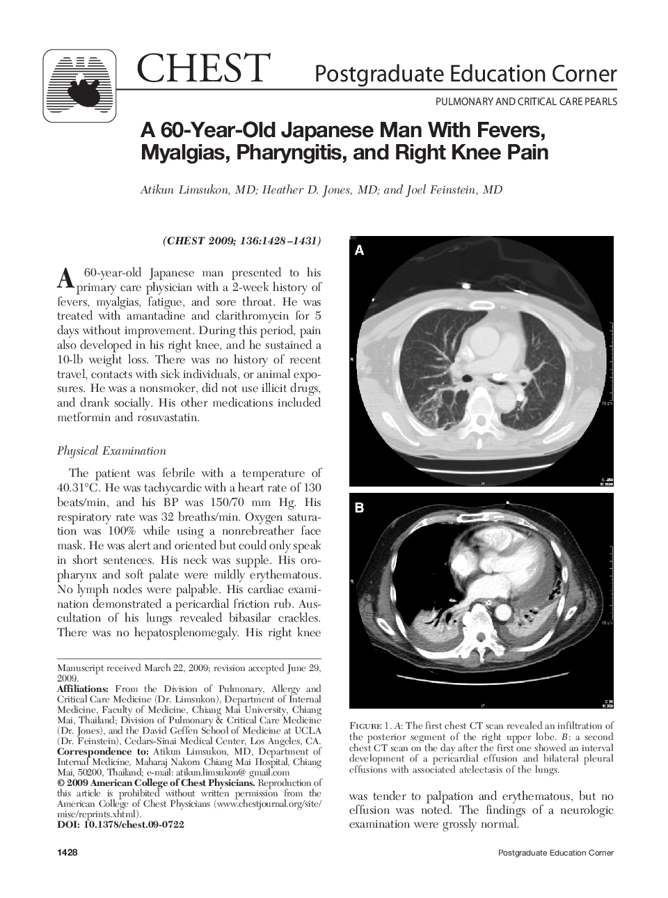 A 60-Year-Old Japanese Man With Fevers, Myalgias, Pharyngitis, and Right Knee Pain