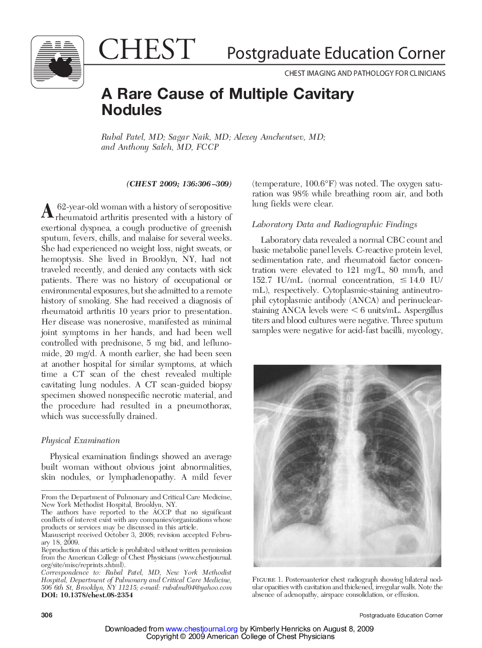 عکس صفحه اول مقاله: A Rare Cause of Multiple Cavitary Nodules A Rare Cause of Multiple Cavitary Nodules