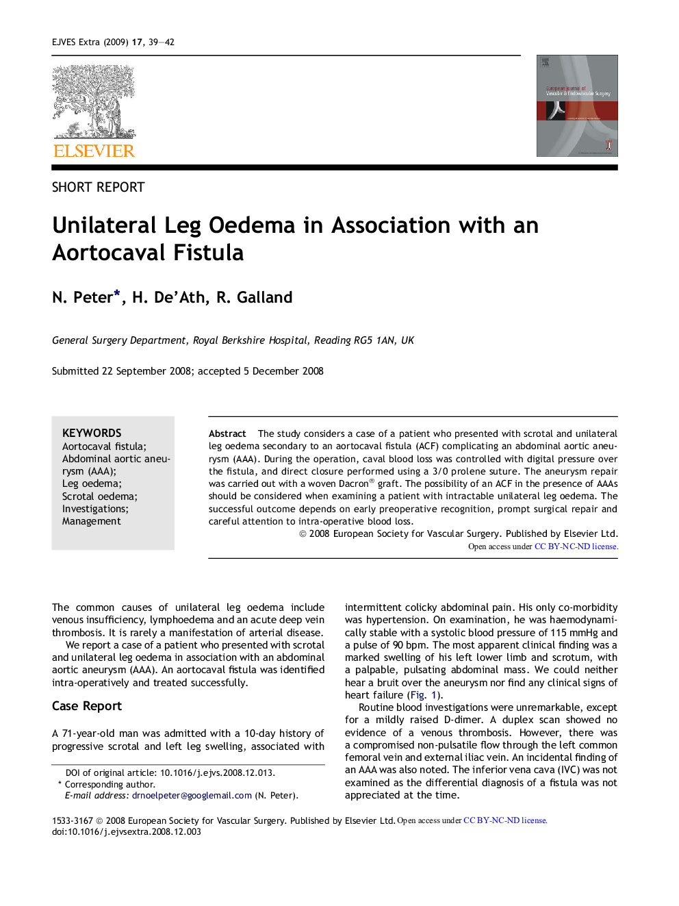 Unilateral Leg Oedema in Association with an Aortocaval Fistula