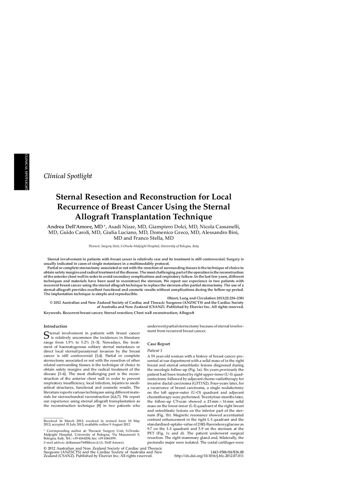 Sternal Resection and Reconstruction for Local Recurrence of Breast Cancer Using the Sternal Allograft Transplantation Technique