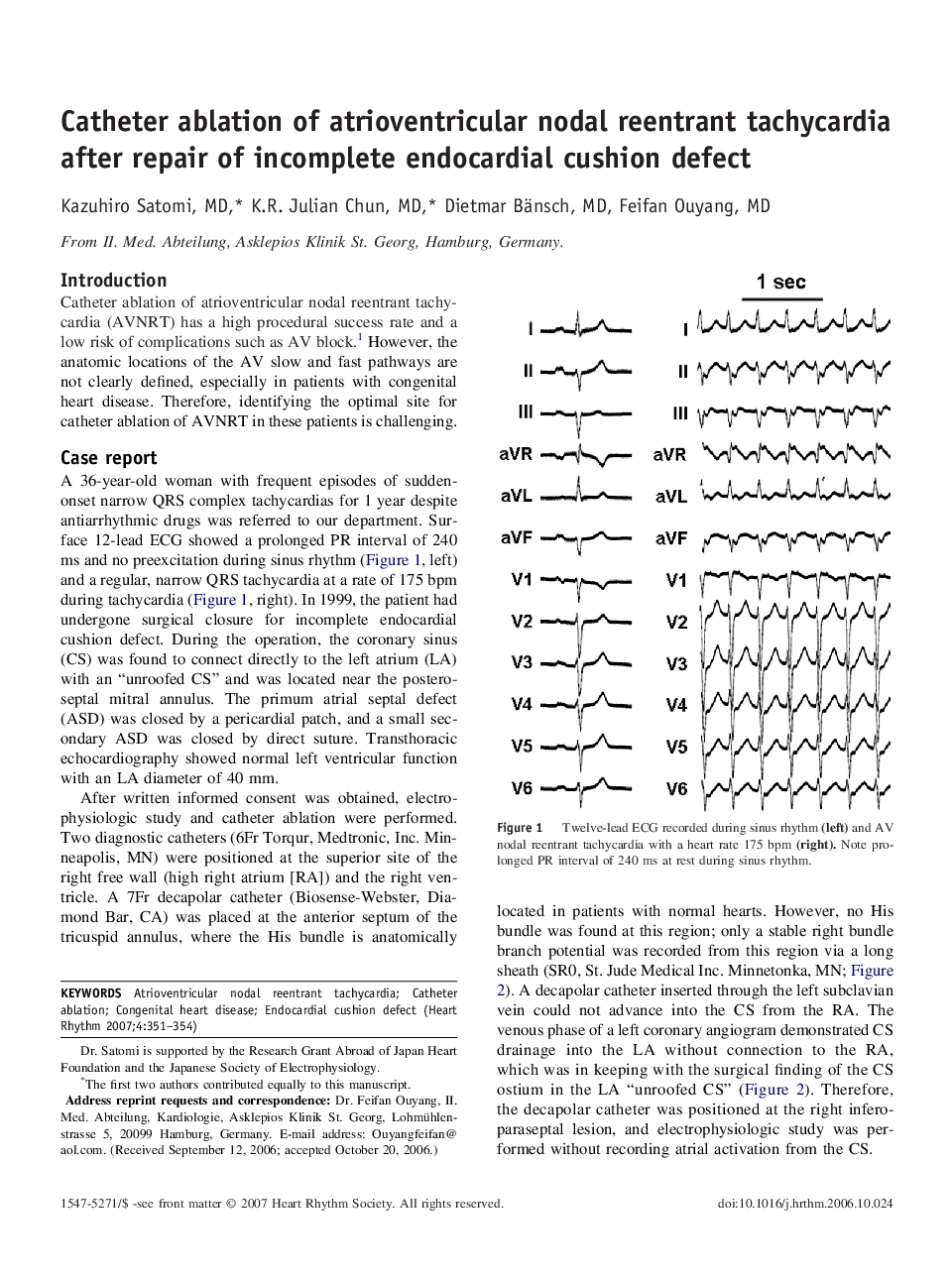 Catheter ablation of atrioventricular nodal reentrant tachycardia after repair of incomplete endocardial cushion defect