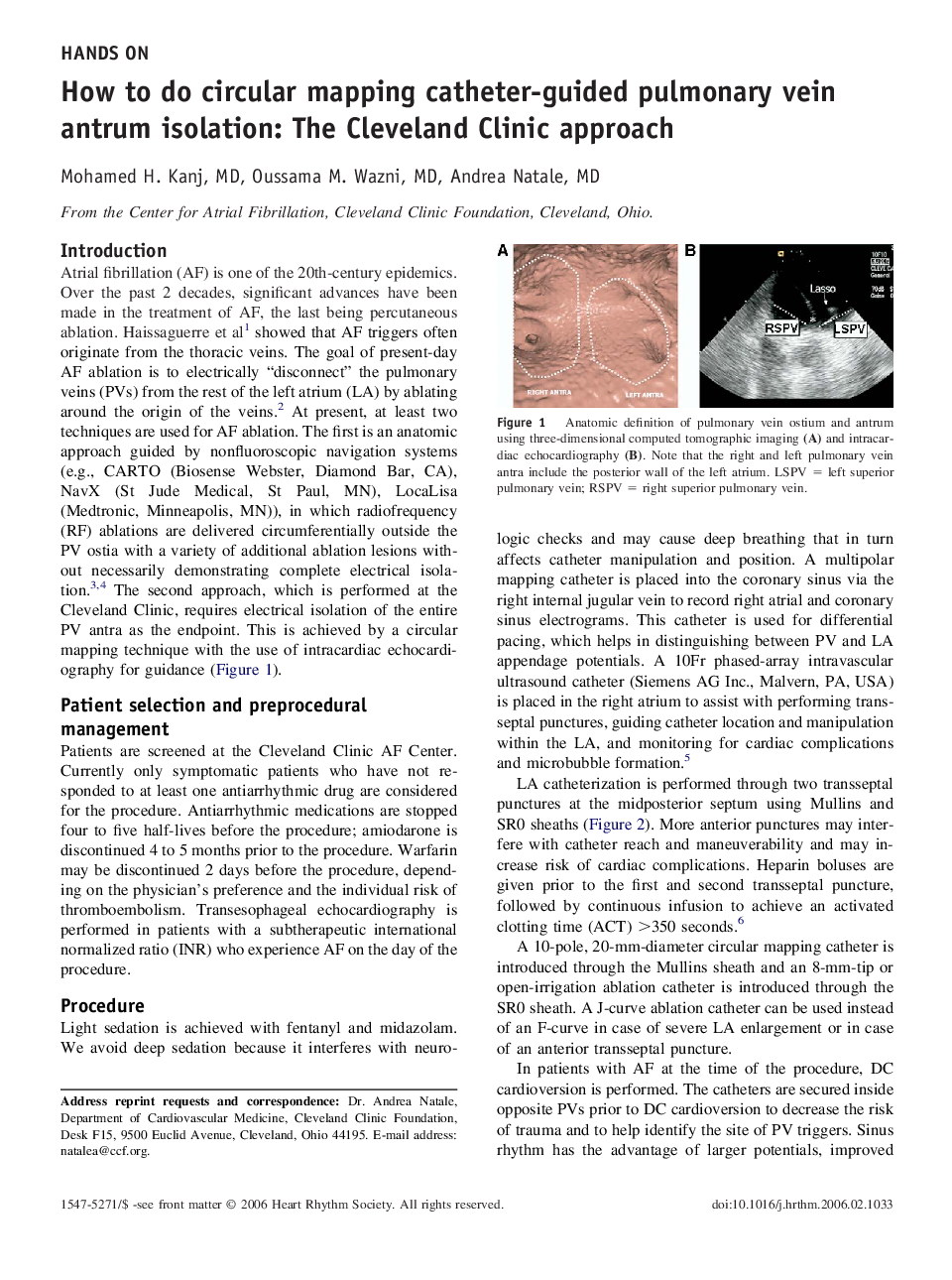 How to do circular mapping catheter-guided pulmonary vein antrum isolation: The Cleveland Clinic approach