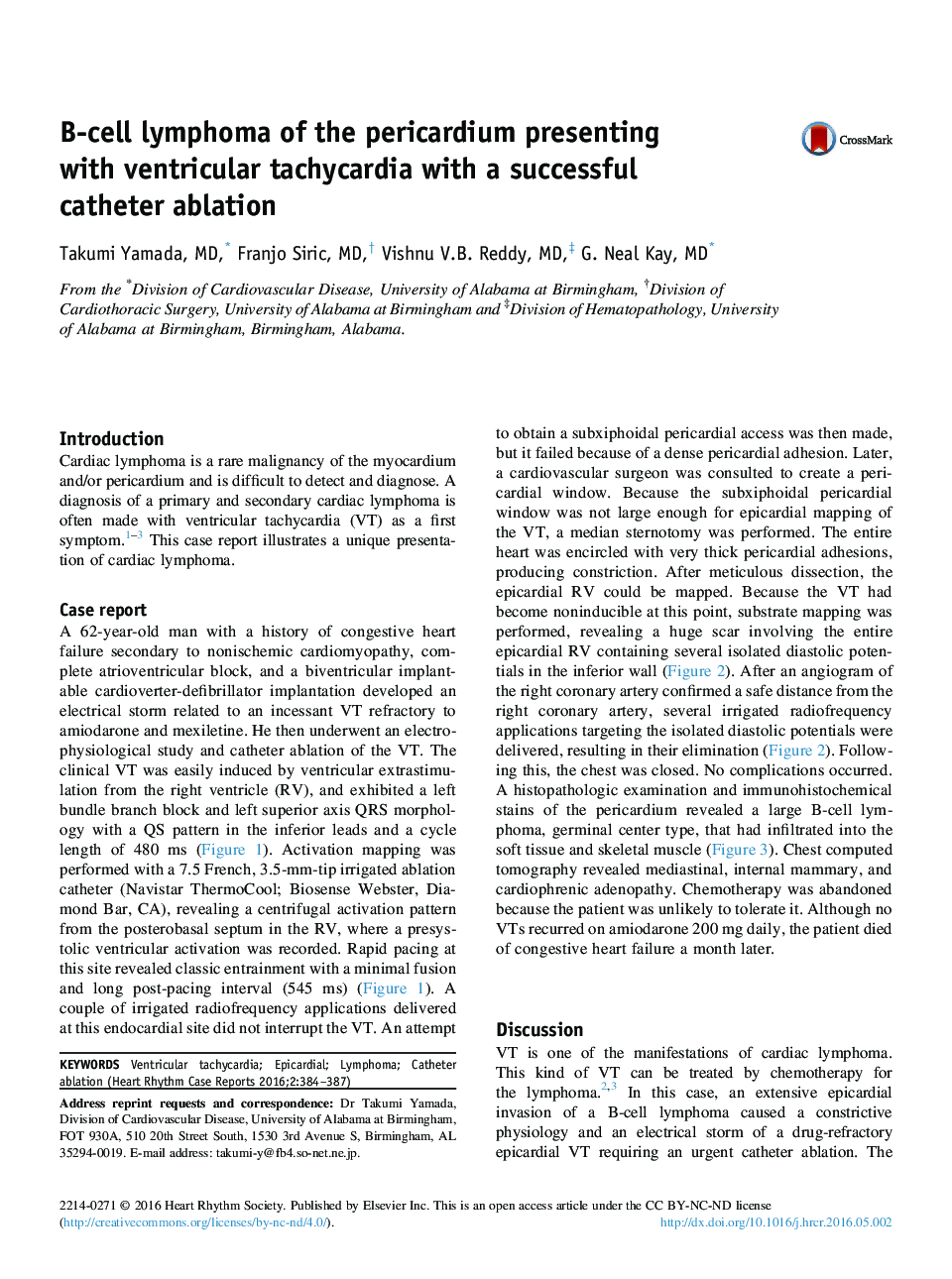 B-cell lymphoma of the pericardium presenting with ventricular tachycardia with a successful catheter ablation