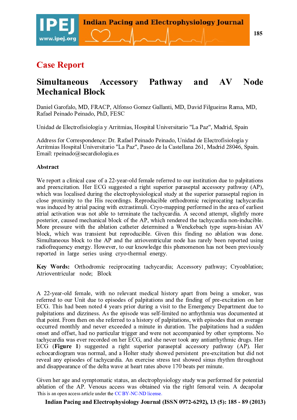 Simultaneous Accessory Pathway and AV Node Mechanical Block