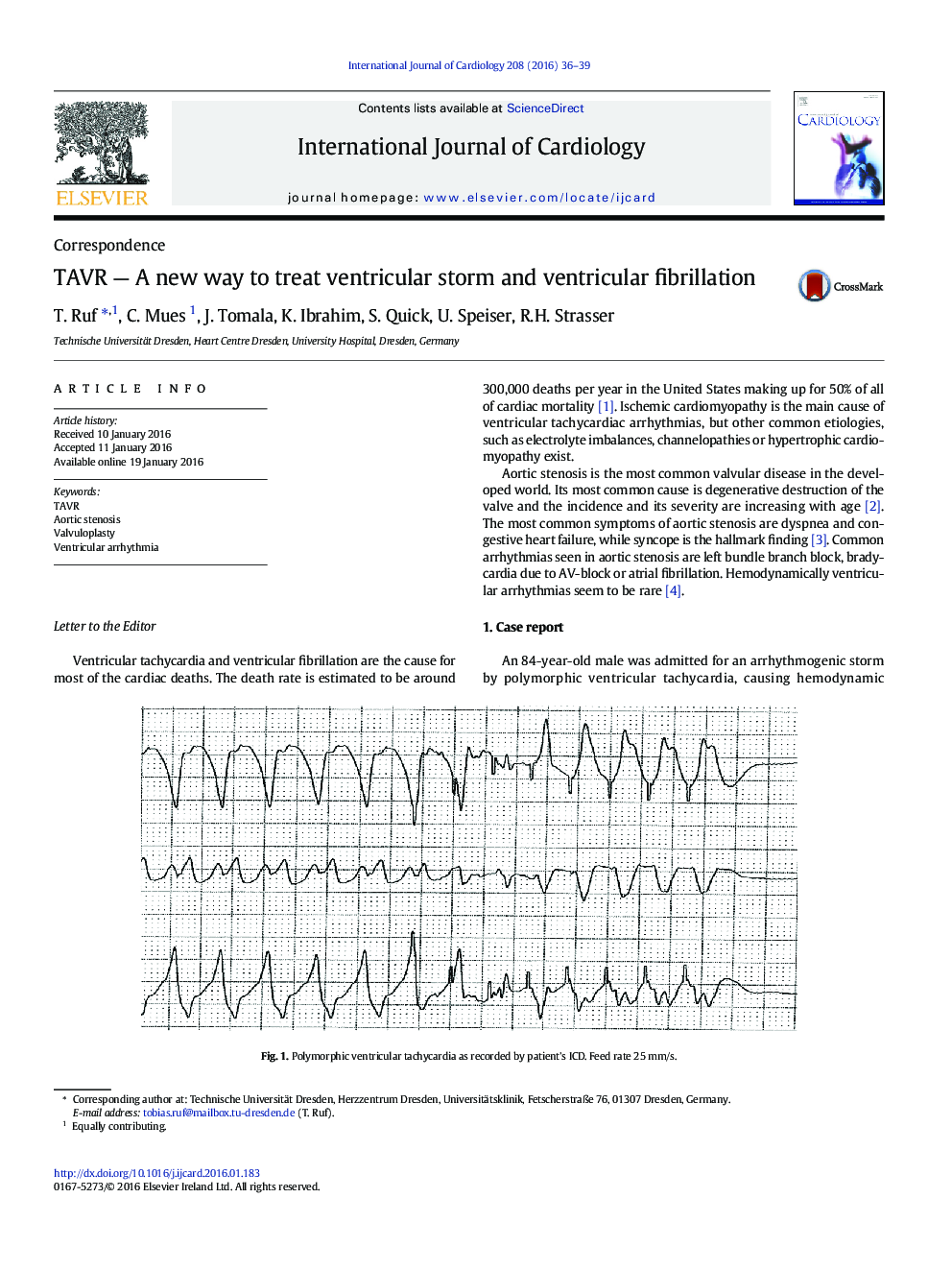عکس صفحه اول مقاله: TAVR - A new way to treat ventricular storm and ventricular fibrillation TAVR - A new way to treat ventricular storm and ventricular fibrillation