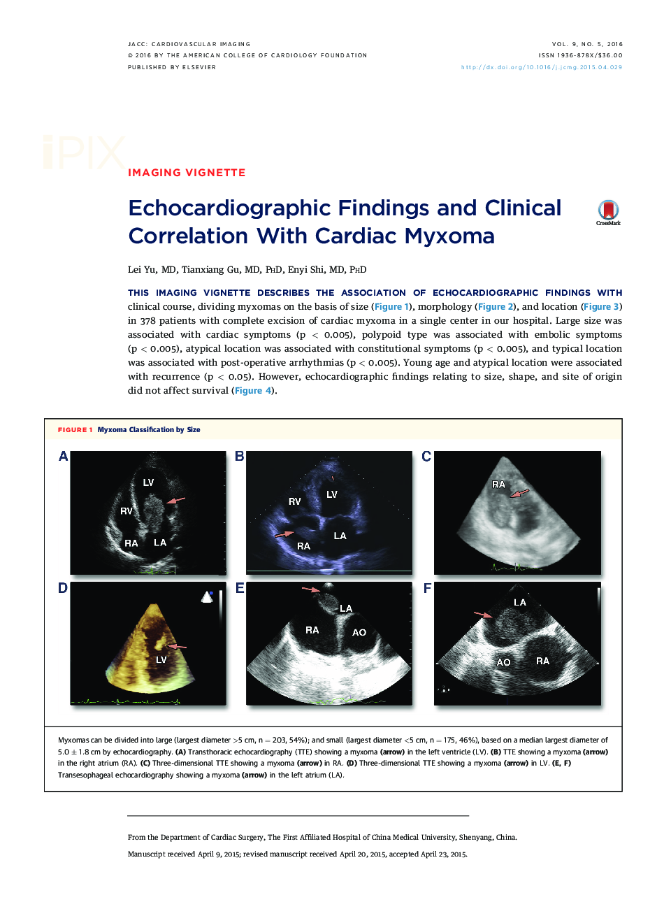 Echocardiographic Findings and Clinical Correlation With Cardiac Myxoma