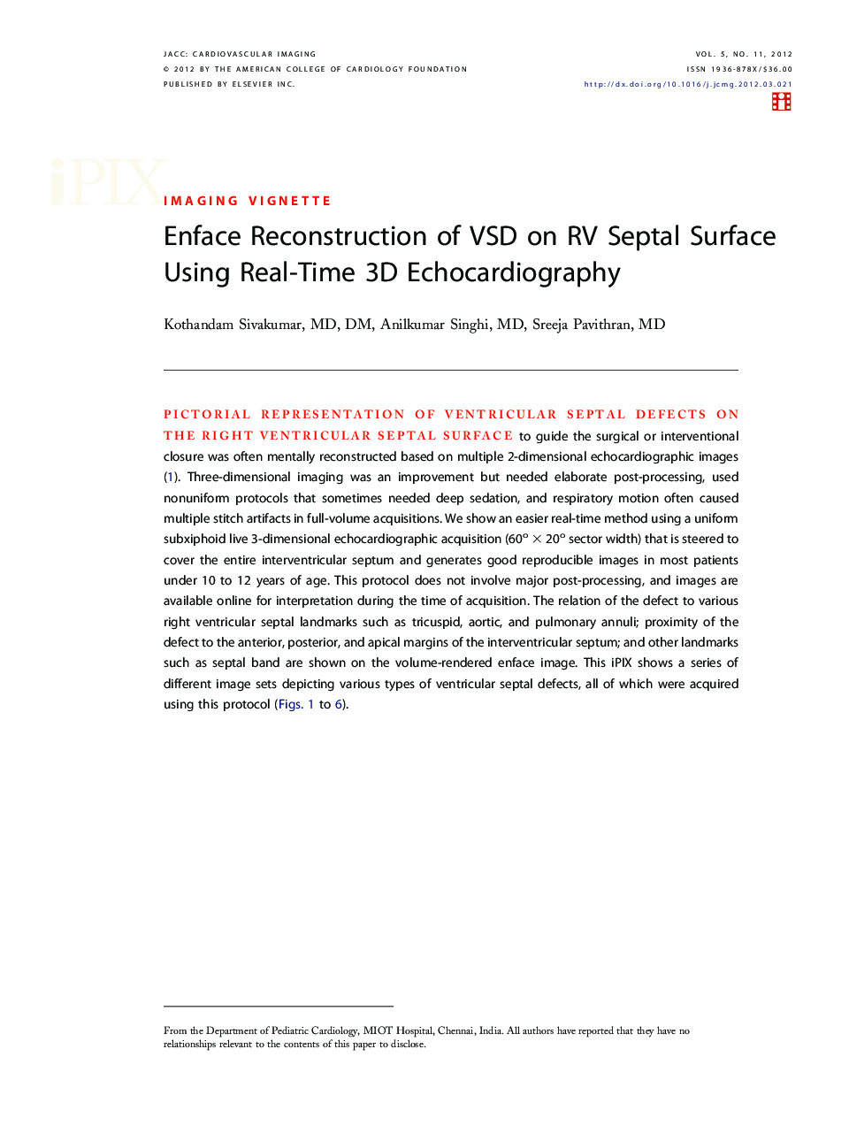 عکس صفحه اول مقاله: Enface Reconstruction of VSD on RV Septal Surface Using Real-Time 3D Echocardiography Enface Reconstruction of VSD on RV Septal Surface Using Real-Time 3D Echocardiography