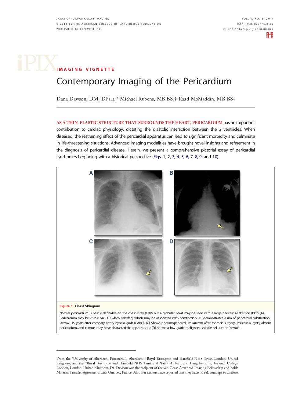 Contemporary Imaging of the Pericardium