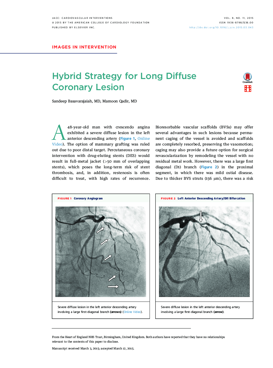 Hybrid Strategy for Long Diffuse CoronaryÂ Lesion
