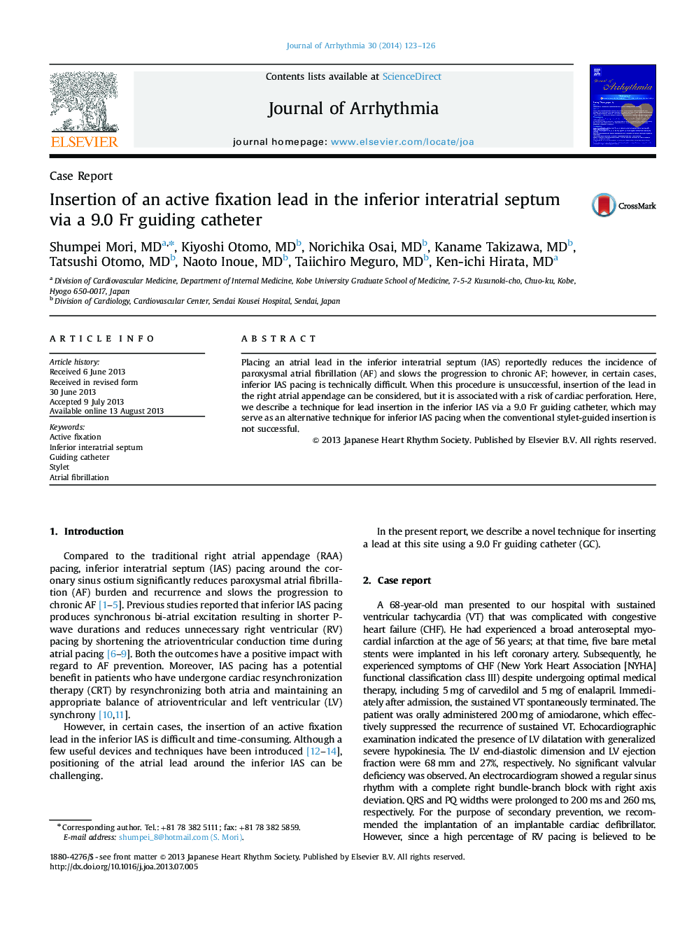 Insertion of an active fixation lead in the inferior interatrial septum via a 9.0 Fr guiding catheter