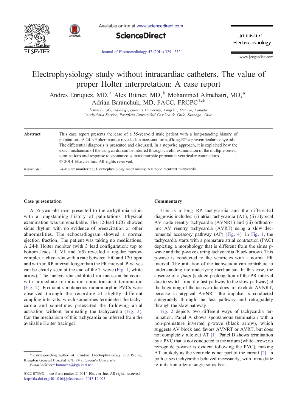 Electrophysiology study without intracardiac catheters. The value of proper Holter interpretation: A case report