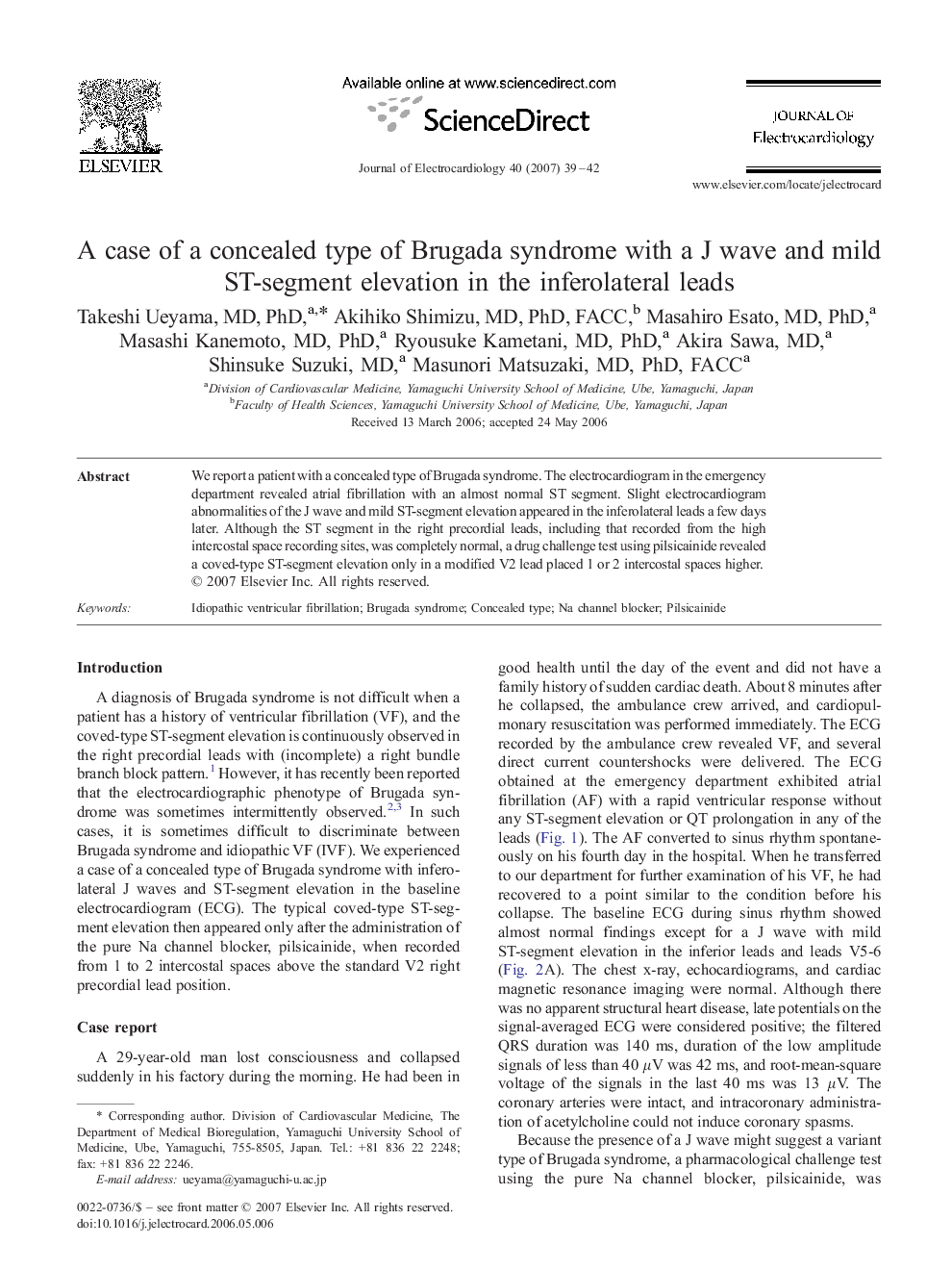 A case of a concealed type of Brugada syndrome with a J wave and mild ST-segment elevation in the inferolateral leads