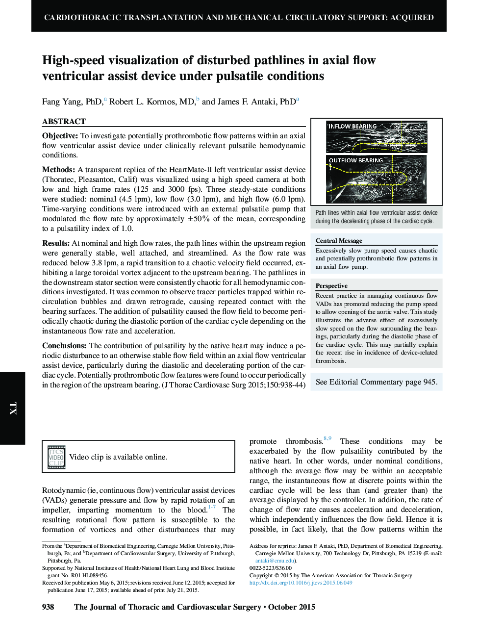 High-speed visualization of disturbed pathlines in axial flow ventricular assist device under pulsatile conditions 