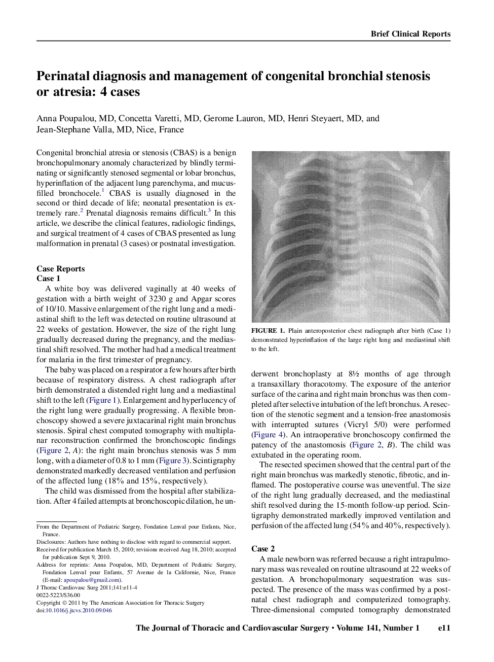 Perinatal diagnosis and management of congenital bronchial stenosis or atresia: 4 cases