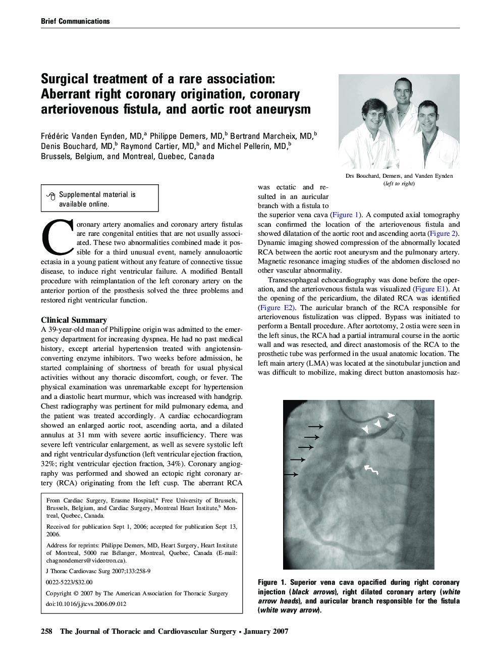 Surgical treatment of a rare association: Aberrant right coronary origination, coronary arteriovenous fistula, and aortic root aneurysm