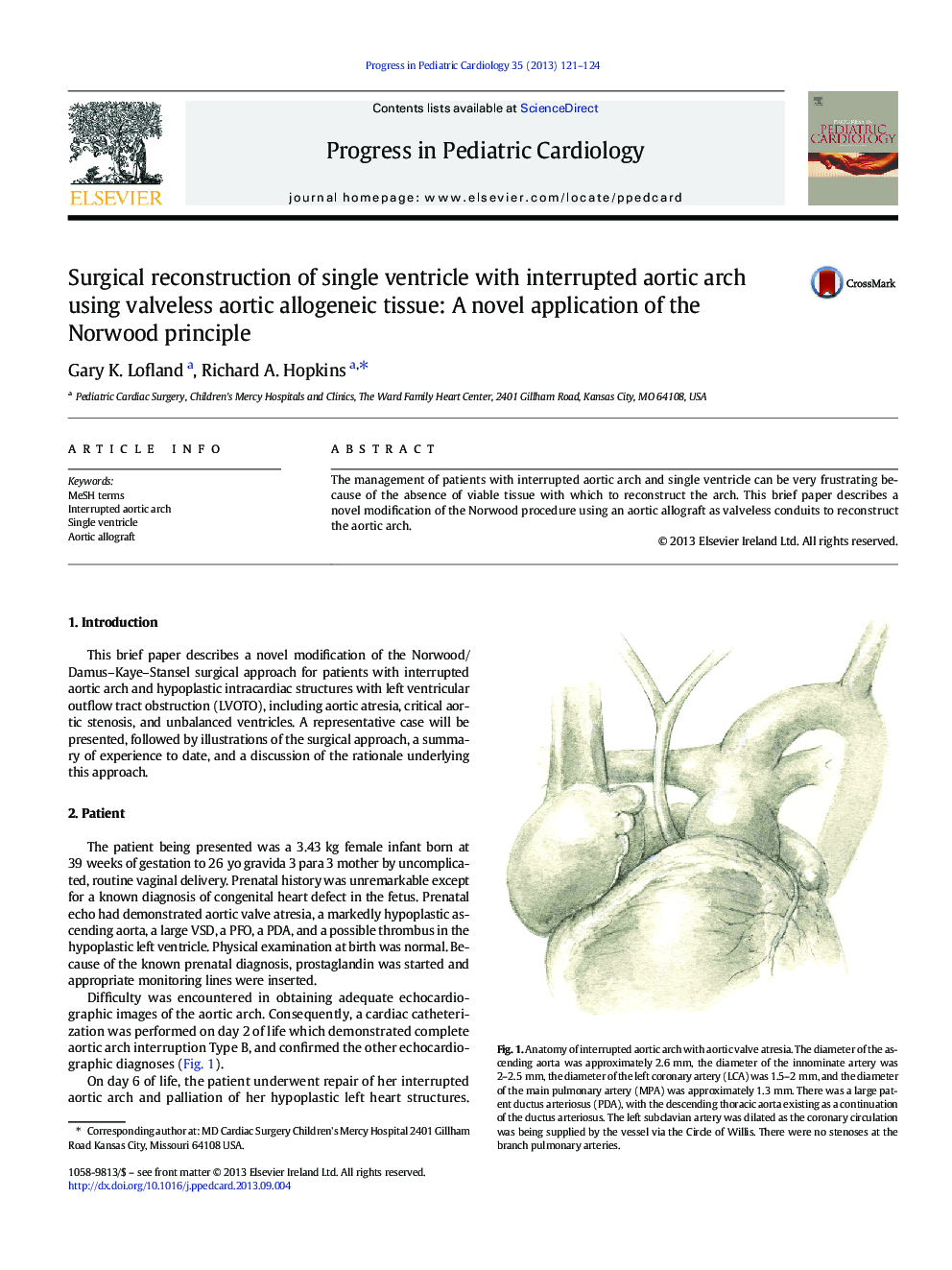 Surgical reconstruction of single ventricle with interrupted aortic arch using valveless aortic allogeneic tissue: A novel application of the Norwood principle