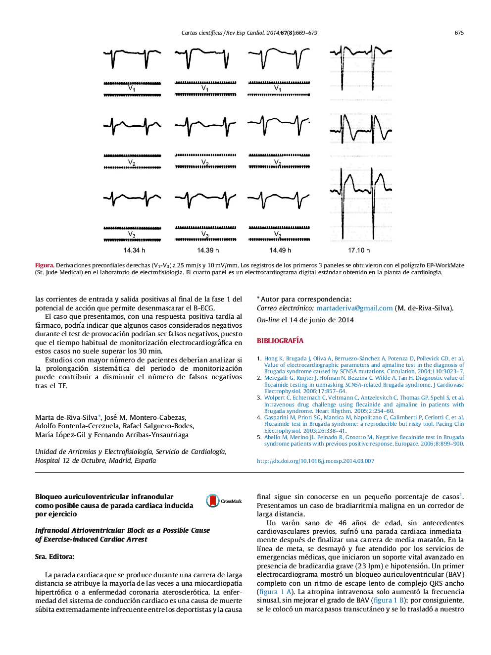 Bloqueo auriculoventricular infranodular como posible causa de parada cardiaca inducida por ejercicio