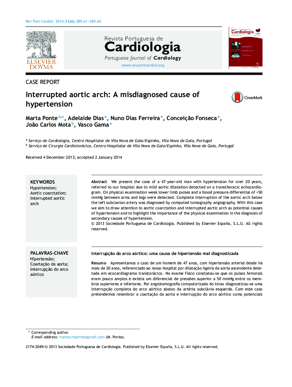 Interrupted aortic arch: A misdiagnosed cause of hypertension