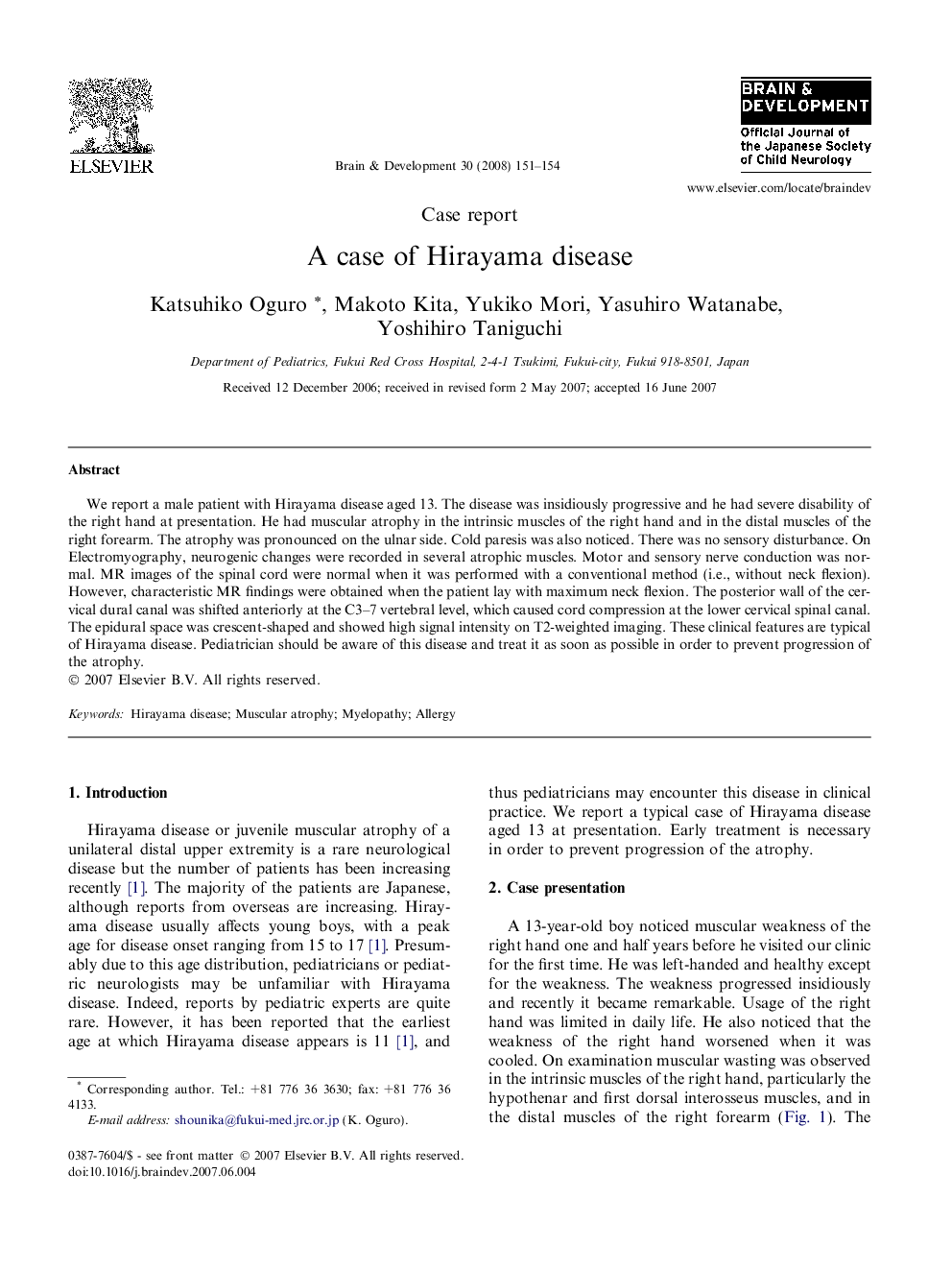 A case of Hirayama disease