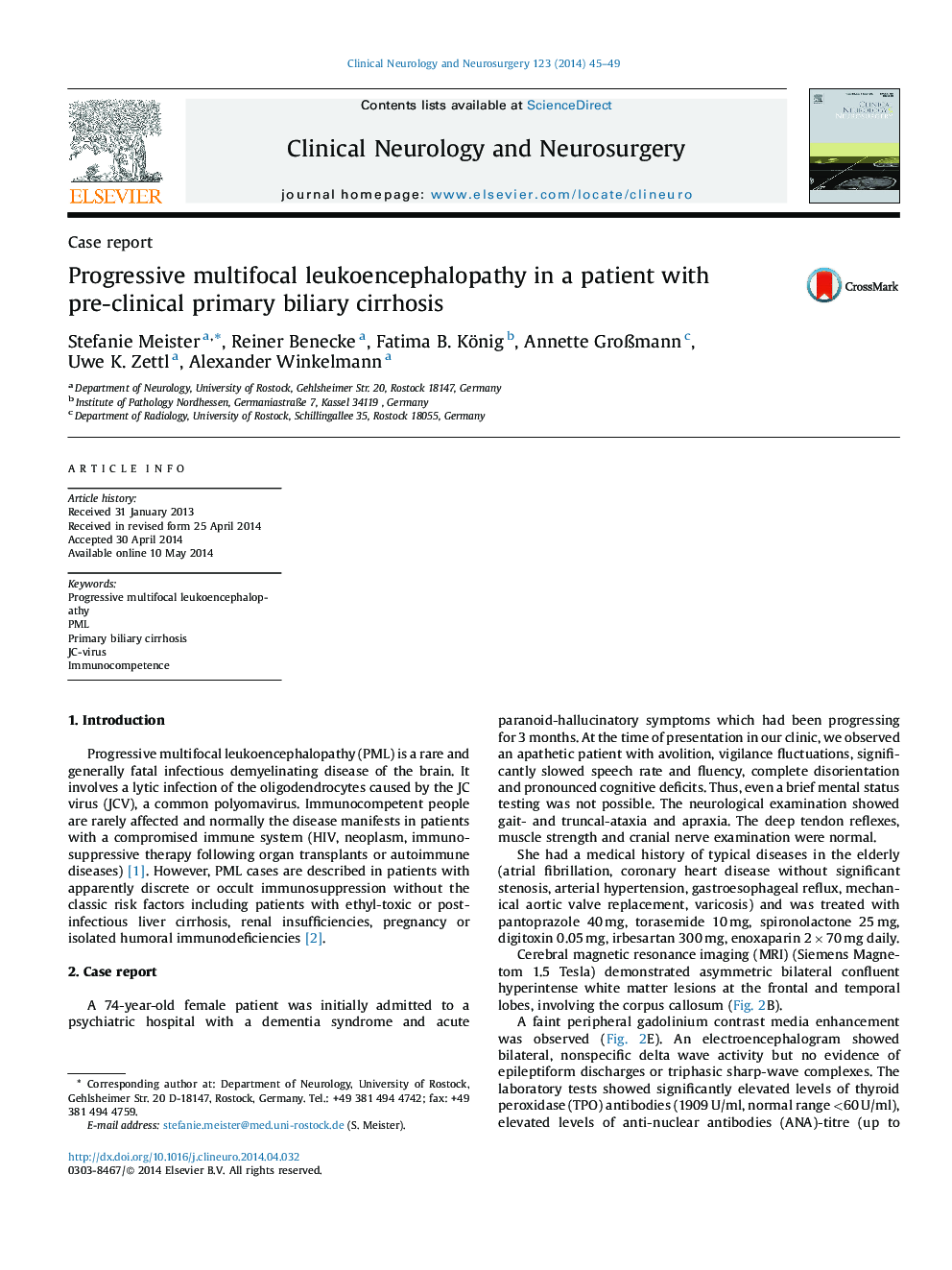 Progressive multifocal leukoencephalopathy in a patient with pre-clinical primary biliary cirrhosis