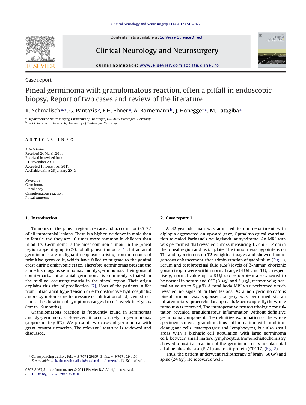 Pineal germinoma with granulomatous reaction, often a pitfall in endoscopic biopsy. Report of two cases and review of the literature