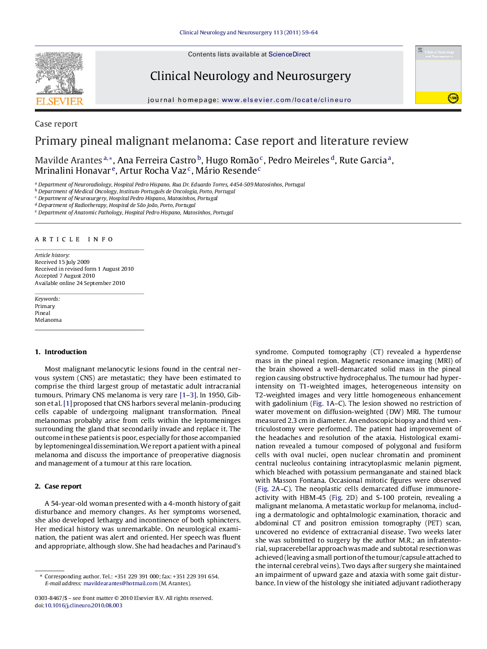 Primary pineal malignant melanoma: Case report and literature review