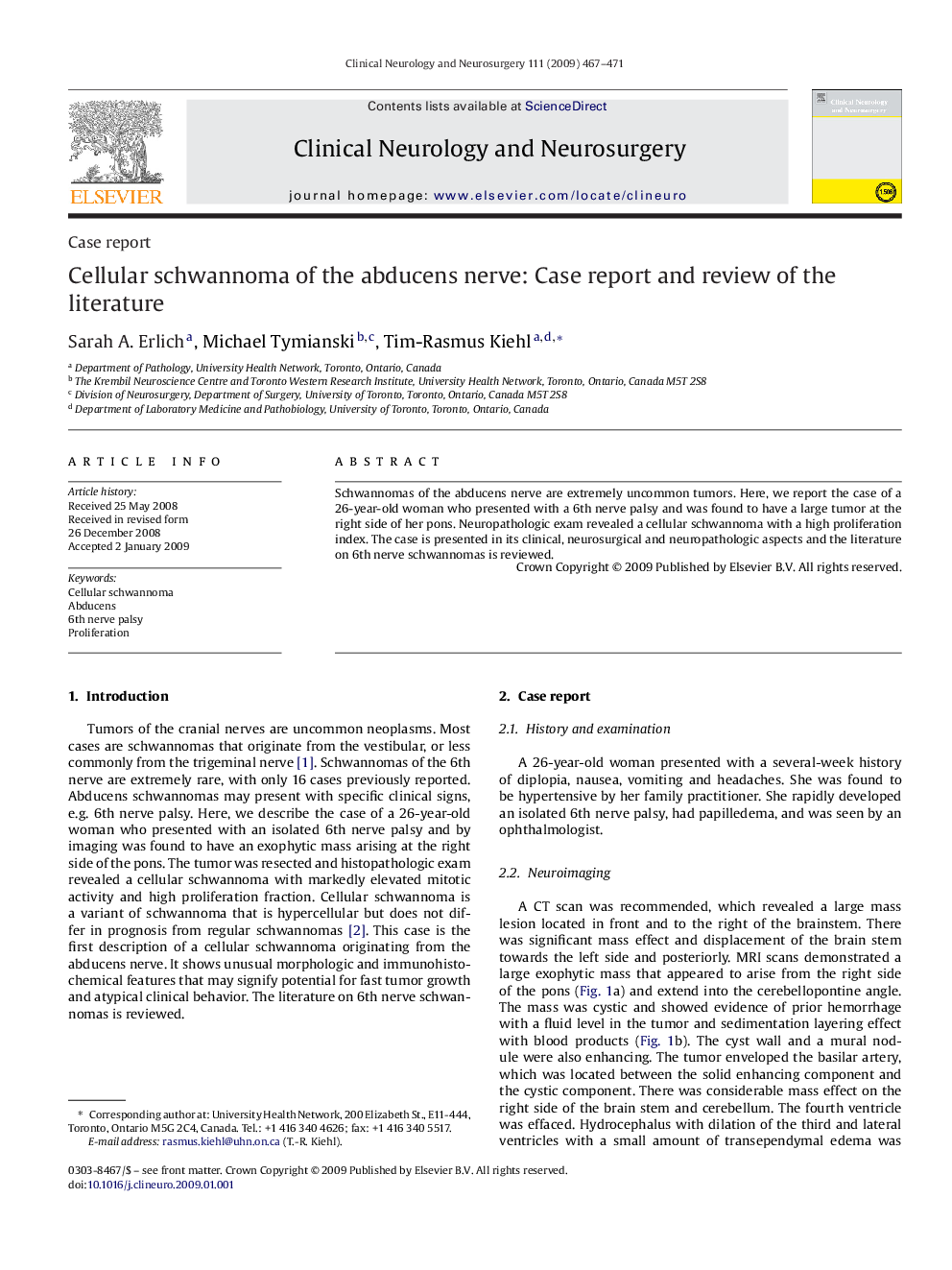 Cellular schwannoma of the abducens nerve: Case report and review of the literature