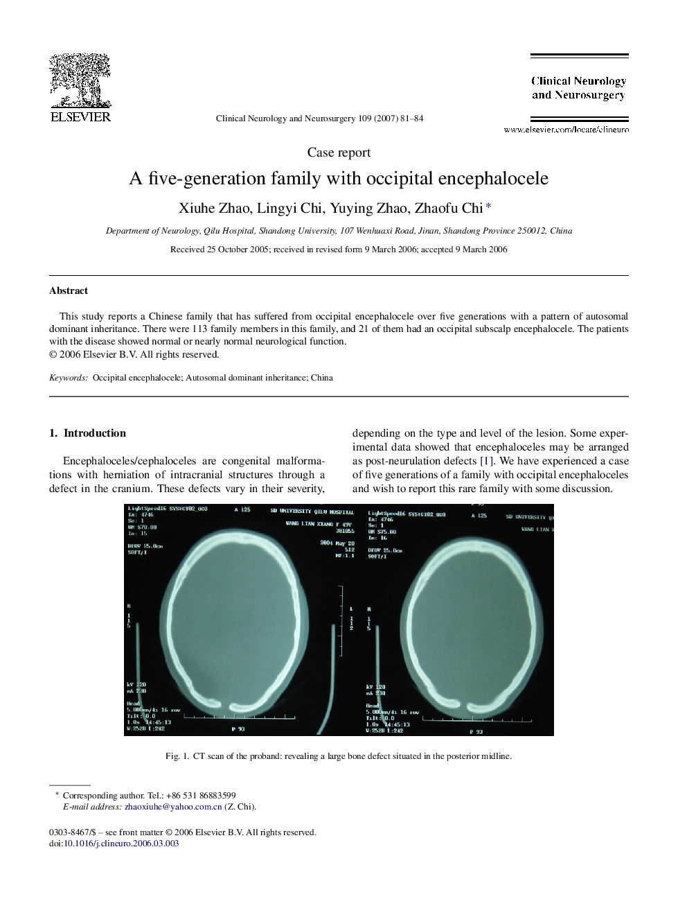 A five-generation family with occipital encephalocele